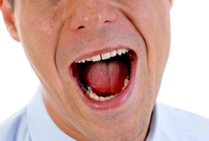 口腔癌存活率 口腔癌存活率