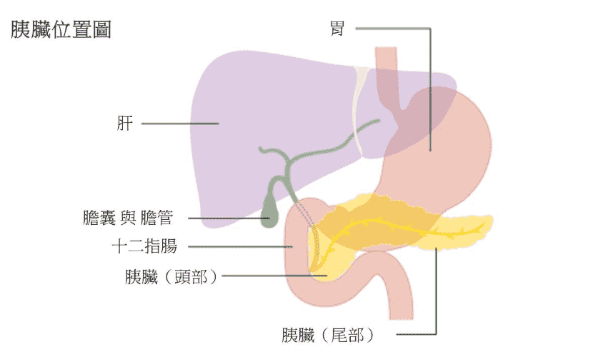 胰臟癌初期