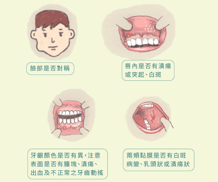 口腔癌診斷 口腔癌診斷