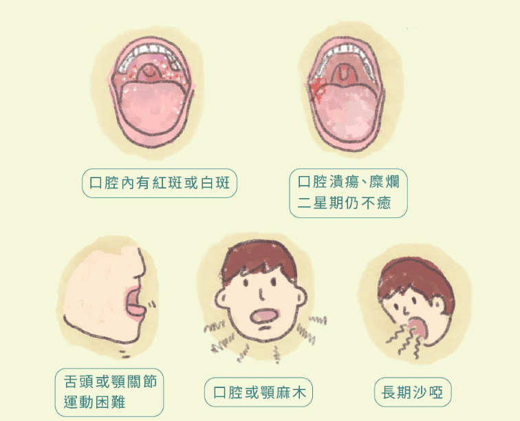 口腔癌自我檢查 口腔癌自我檢查
